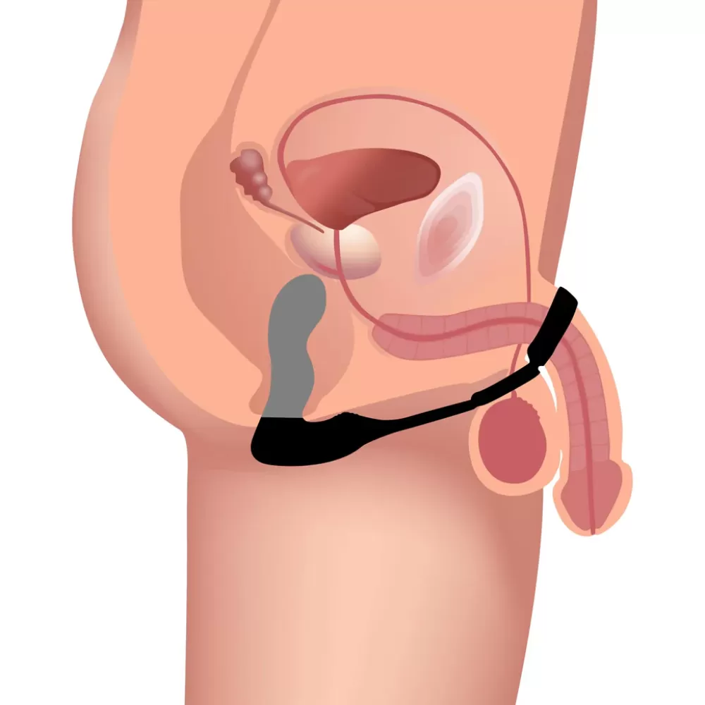 Shop Healthy & Active 10X Inflatable and Vibrating Prostate Plug with C&B Ring