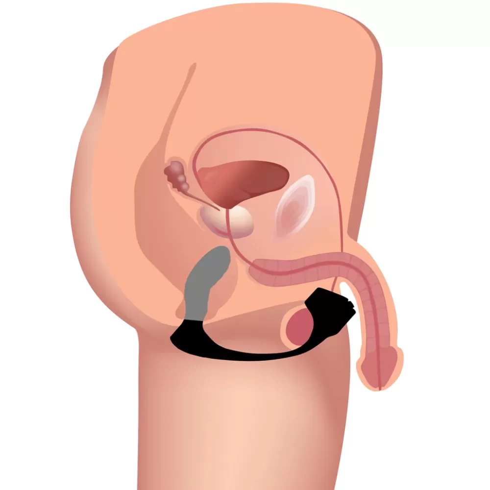 Best Sale Healthy & Active 7X Silicone Prostate Plug with Ball Stretcher and Remote
